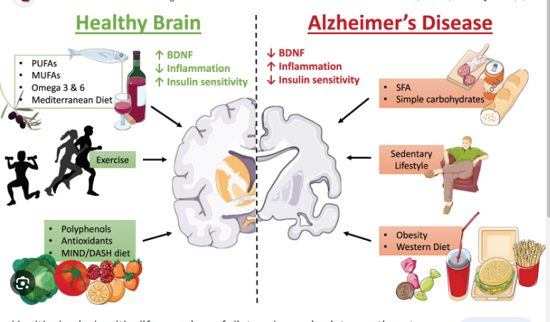 healthiest lifestyle possible for the brain